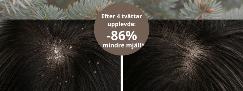 mjäll, dandruff